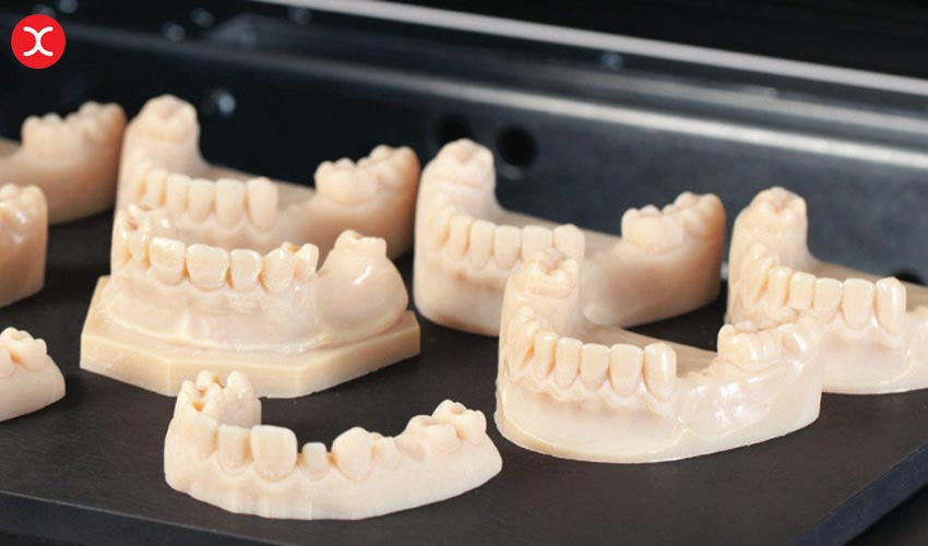 کاربرد های پرینت سه بعدی در صنعت دندان پزشکی