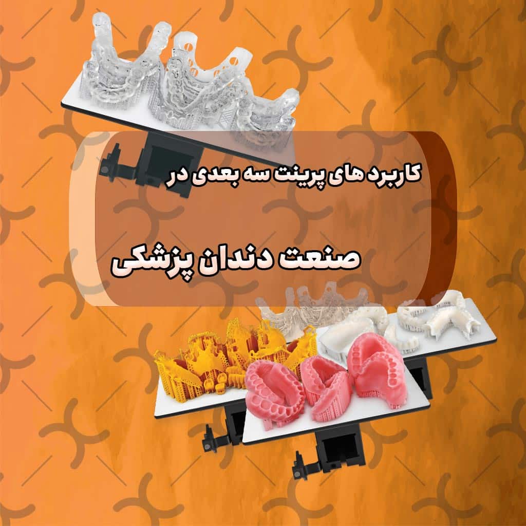 کاربرد های پرینت سه بعدی در صنعت دندان پزشکی